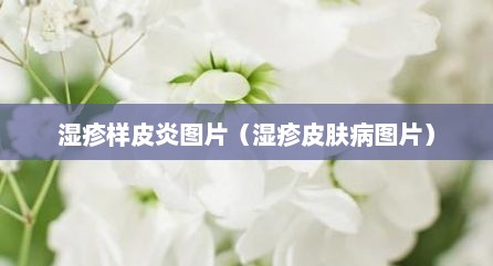 湿疹样皮炎图片（湿疹皮肤病图片）