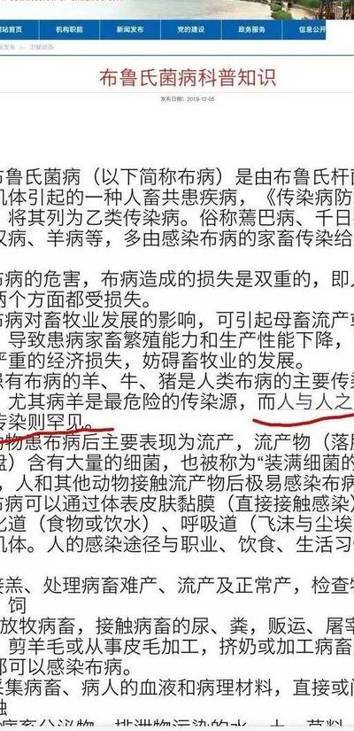 兰州布病是什么病（兰州布病有什么症状?）