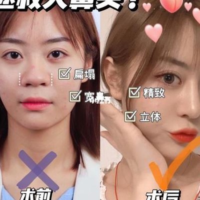 怎么把鼻头变小（怎么把鼻头变小变软）