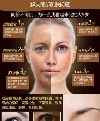 什么眼霜去细纹好(如何有效去除细纹，找到最佳眼霜)