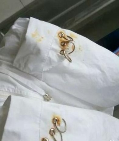白衣服上的铁锈怎么去除（白衣服上的铁锈怎么去除最快最有效了）