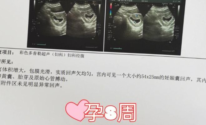 胎心声音（胎心声音音频）