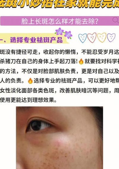 脸上的斑如何去除（脸上的斑如何去除的方法）