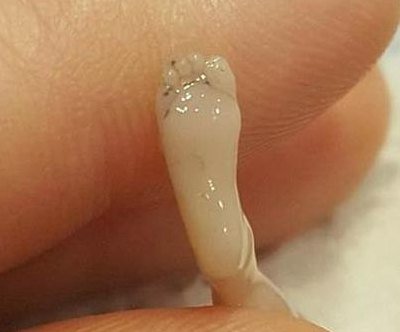 怀孕15周胎儿图片欣赏（孕15周胎宝宝图片）