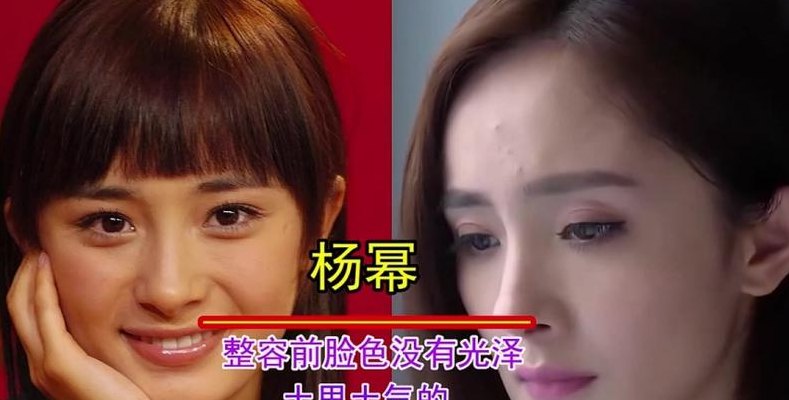 整容的明星（整容的明星不能拍电视剧了吗）