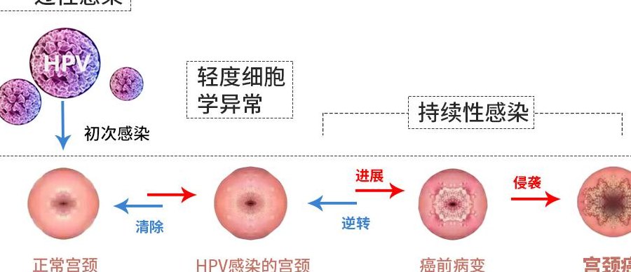 只要没变化就不是尖锐（几年没变化是尖锐吗）