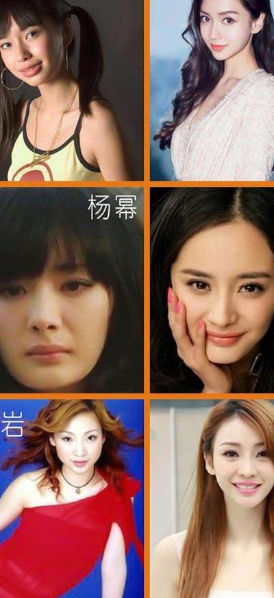 整容明星（整容明星老了的样子）
