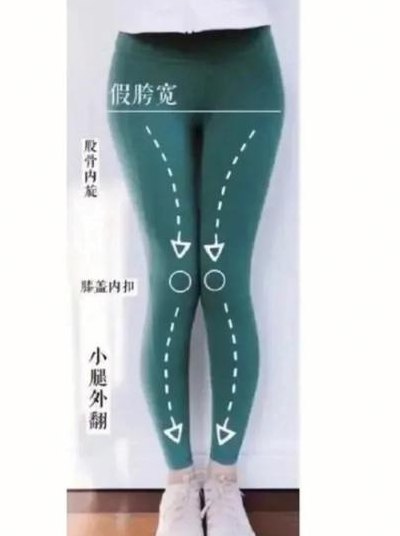 矫正腿型（腿不直怎么矫正腿型）