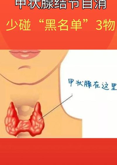 甲亢粗脖子早期图片（甲状腺结节一二三四级对照表）