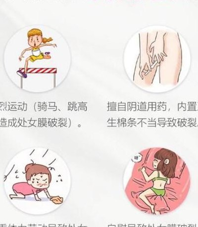 初女膜破裂图的简单介绍