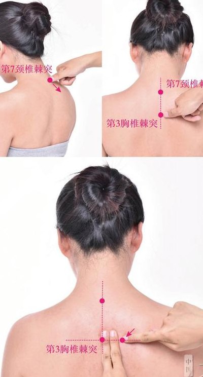 咳嗽拔罐拔哪个位置图（咳嗽拔罐拔哪个位置图片）