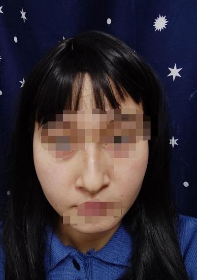 最丑的几种鼻子图片（比较丑的鼻子）