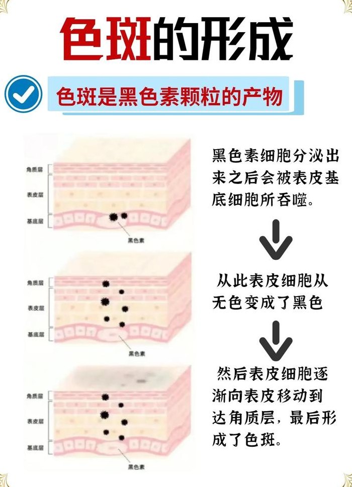 色斑的形成（色斑的形成原因是什么）