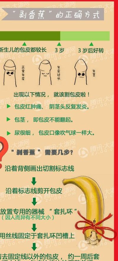 割包皮需要多长时间（割包皮需要多长时间?）