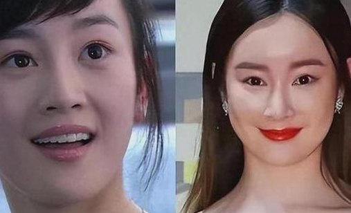 张檬整容前后照片（张檬整容前图）