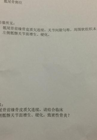 无缘无故尾巴骨疼（无缘无故尾巴骨疼是什么原因造成的）