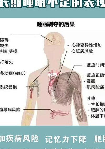 午觉睡太久的危害（长期不睡觉的危害）