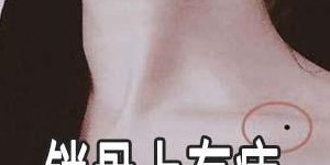 锁骨上有痣（女人锁骨附近的痣图解）