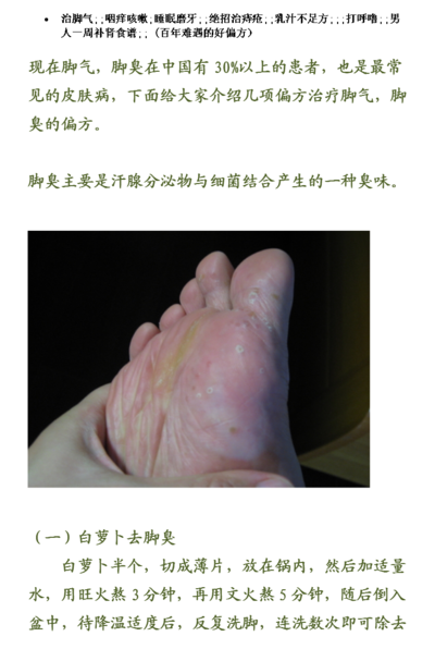 脚气的治疗方法（脚气的治疗方法藿香正气水）