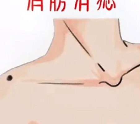 肩上有痣代表什么意思（肩上有痣代表什么意思男）
