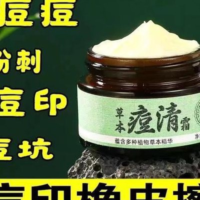 淡化痘印的护肤品（淡化痘印的护肤品有用吗）