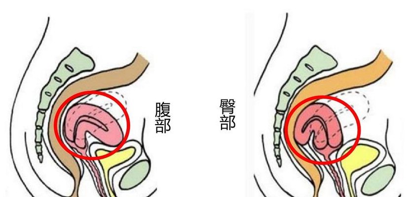 子宫在哪个位置图解（后位子宫是什么意思）