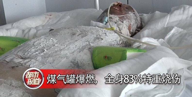 煤气罐在什么情况下会爆炸（煤气罐在什么情况下会爆炸会烧伤吗视频）