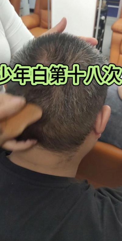 中学生长白头发是怎么回事（中学生出现白头发是怎么回事）