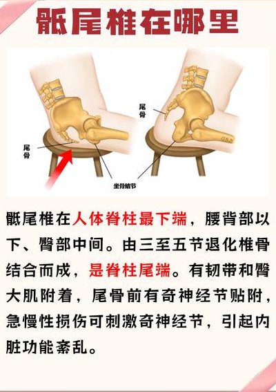 尾椎疼痛部位对照表图（尾椎疼是哪个部位）