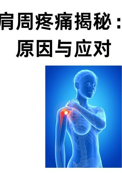 肩膀肿痛对照表图（肩膀痛肿起来怎么办）