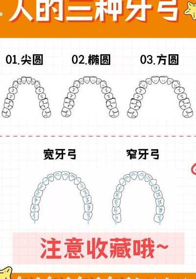 正畸弓形图对照表图解大全（弓形牙齿矫正器）