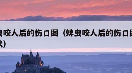 蜱虫咬人后的伤口图（蜱虫咬人后的伤口图及症状）