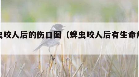 蜱虫咬人后的伤口图（蜱虫咬人后有生命危险吗）
